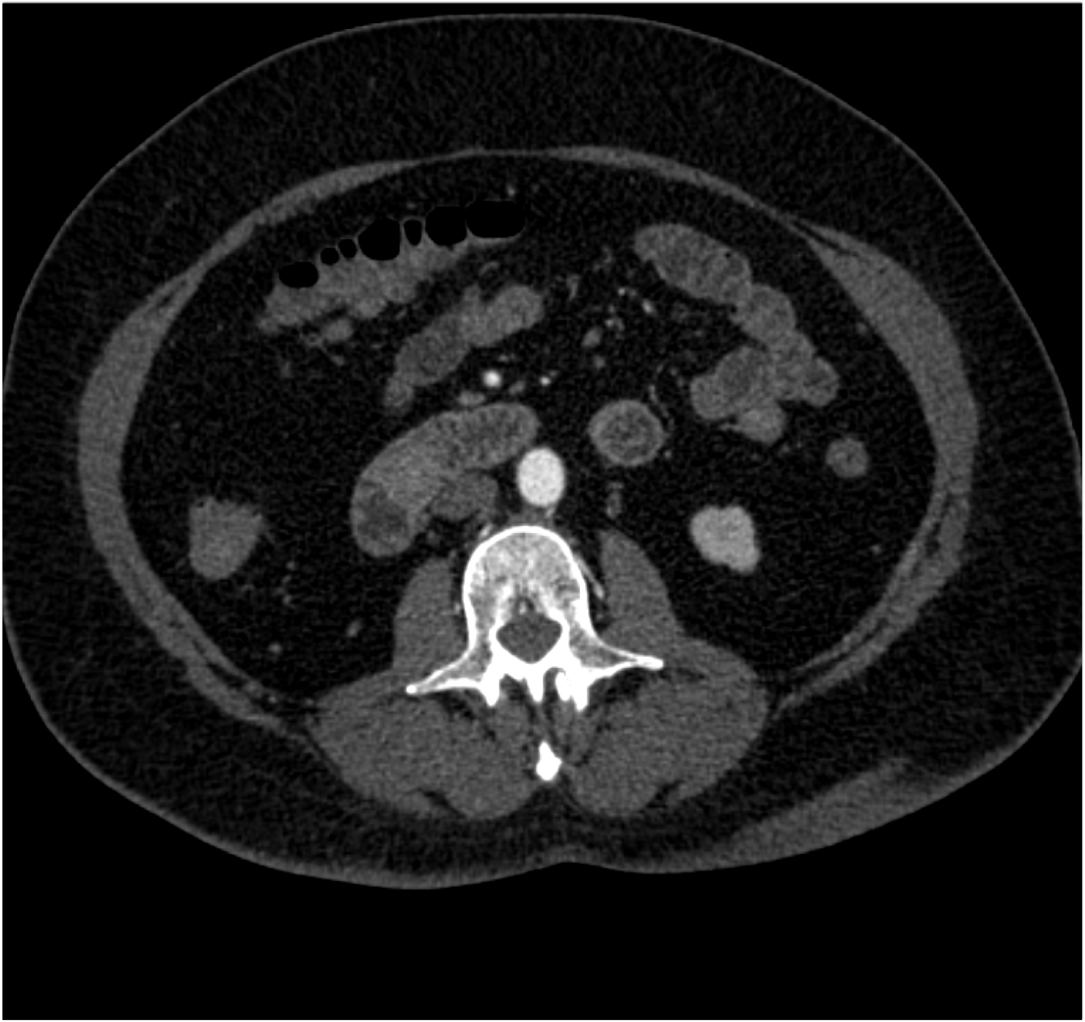 CTisus Quiz