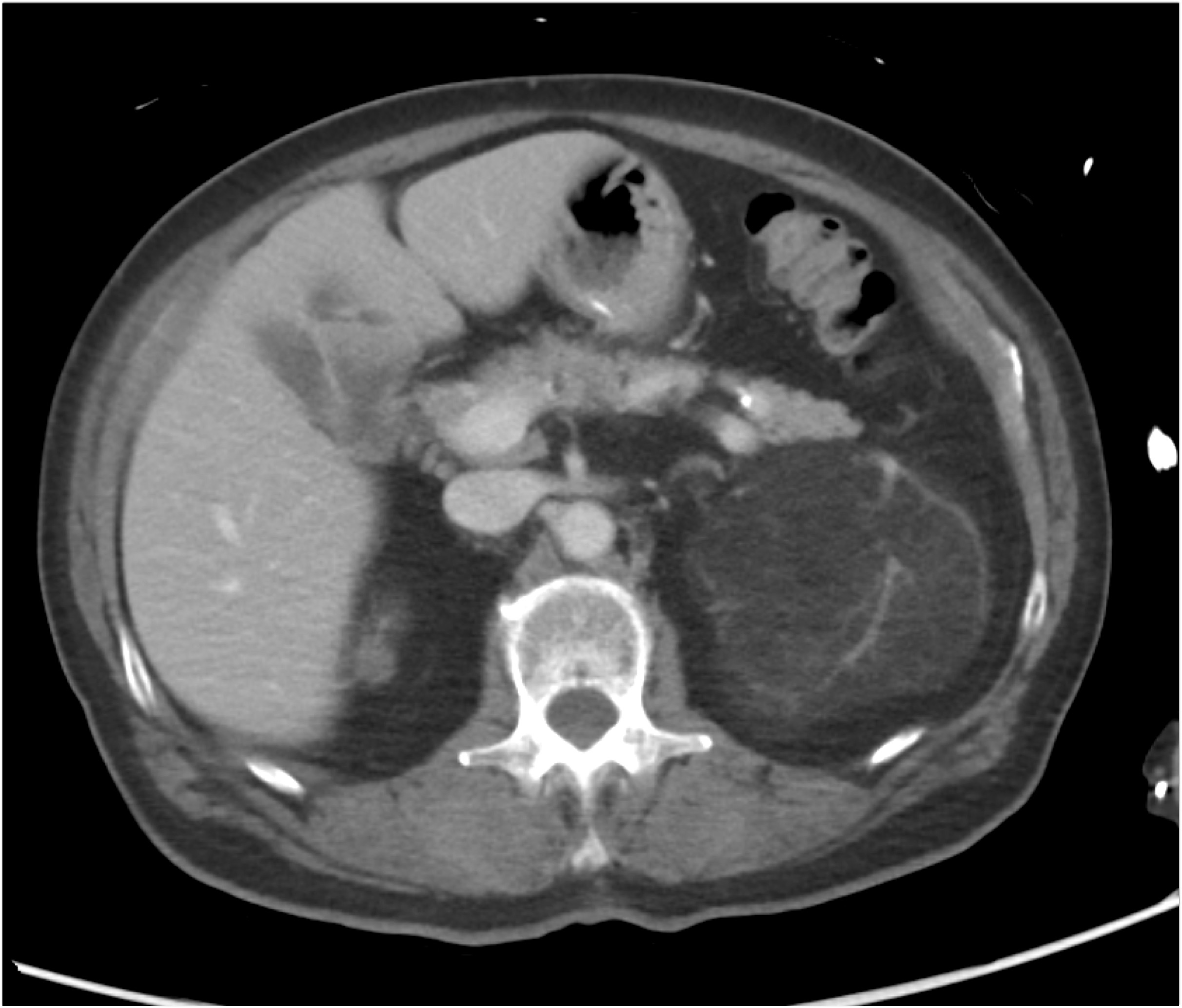 CTisus Quiz