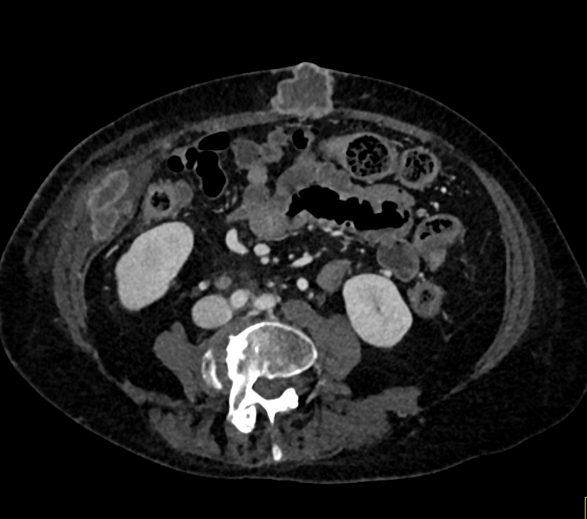 CTisus Quiz