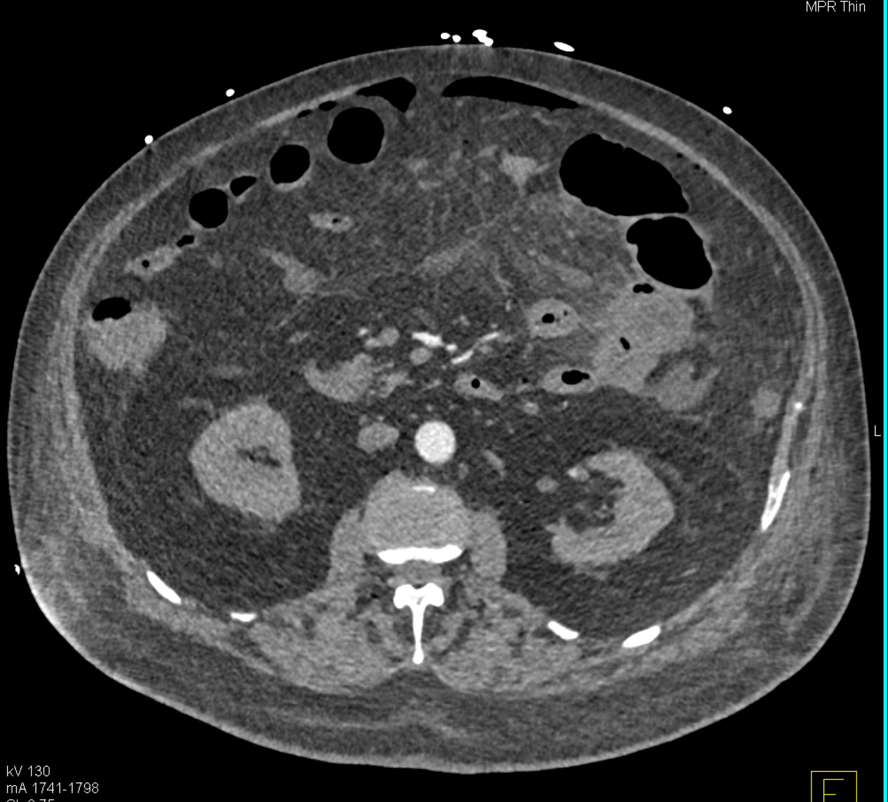 CTisus Quiz