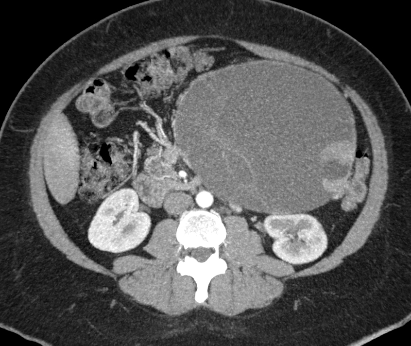 CTisus Quiz