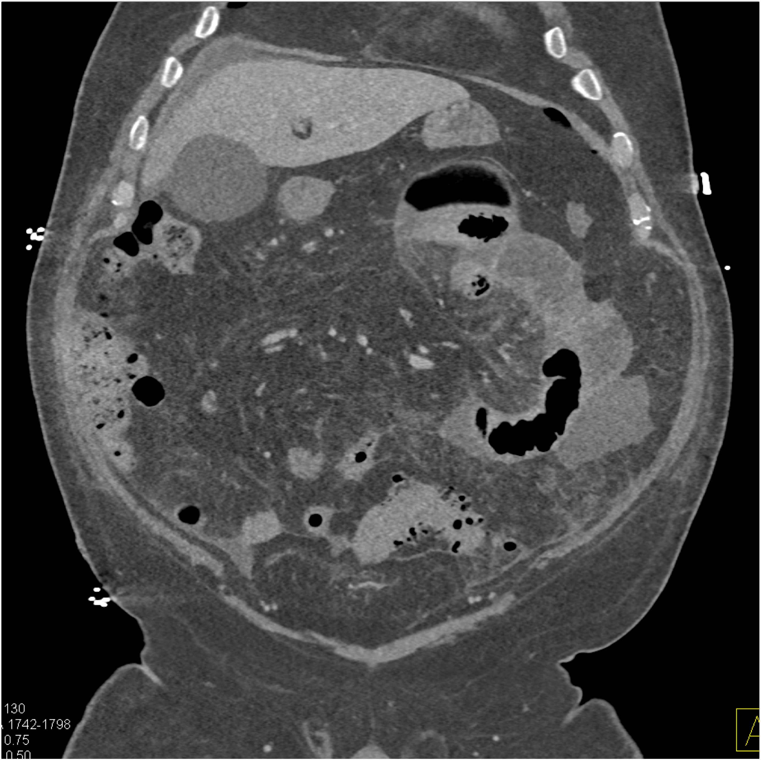 CTisus Quiz