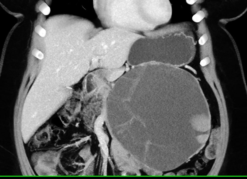 CTisus Quiz