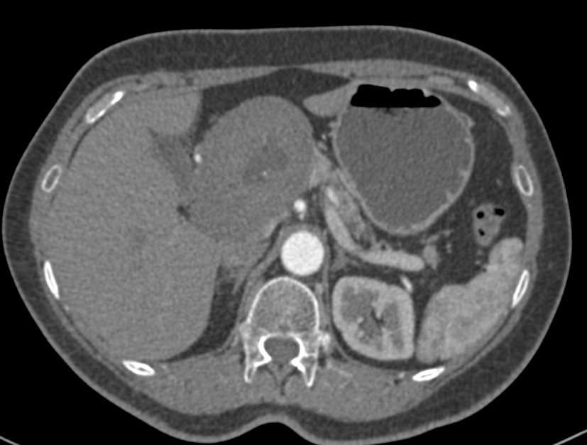CTisus Quiz