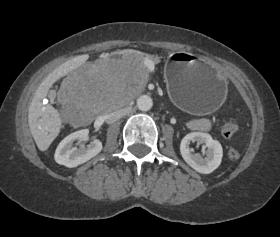 CTisus Quiz