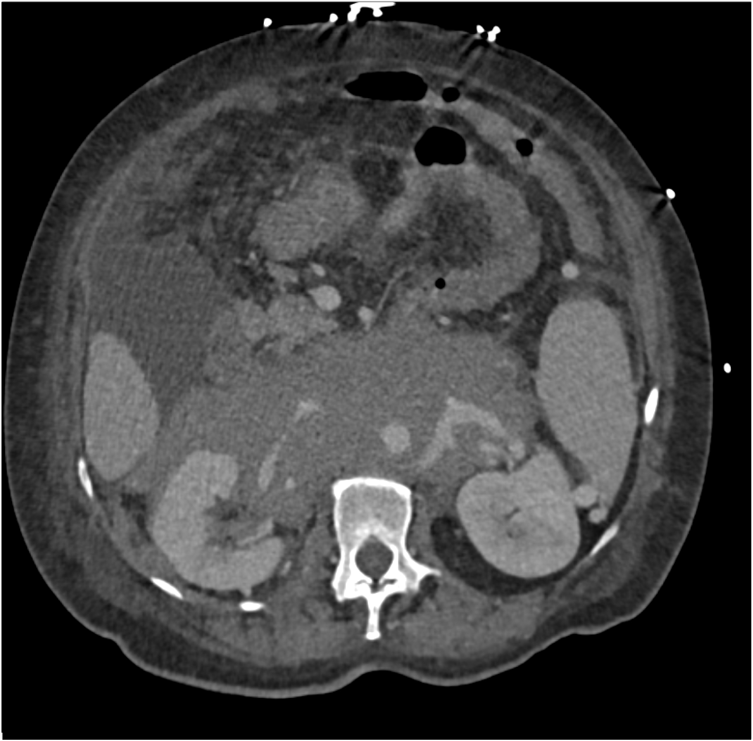 CTisus Quiz