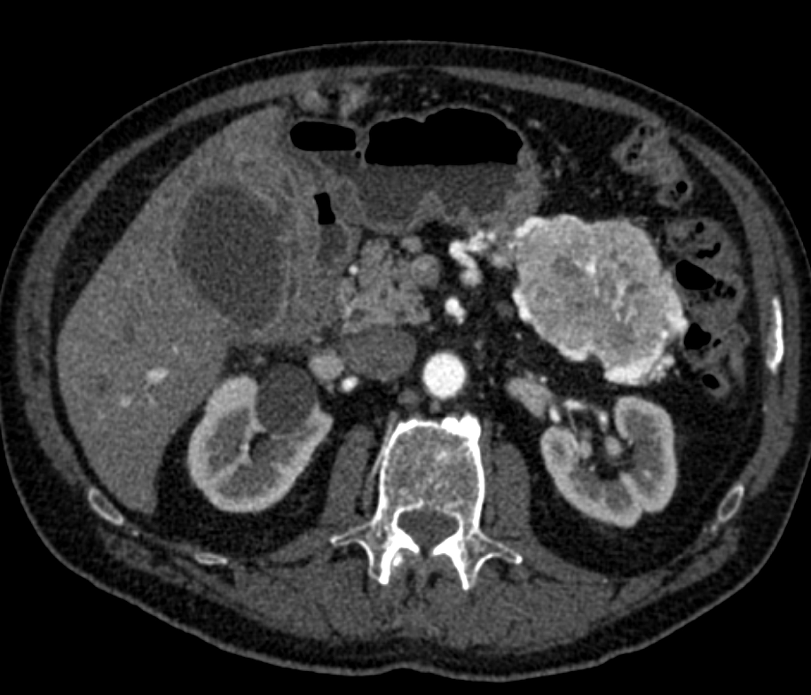 CTisus Quiz
