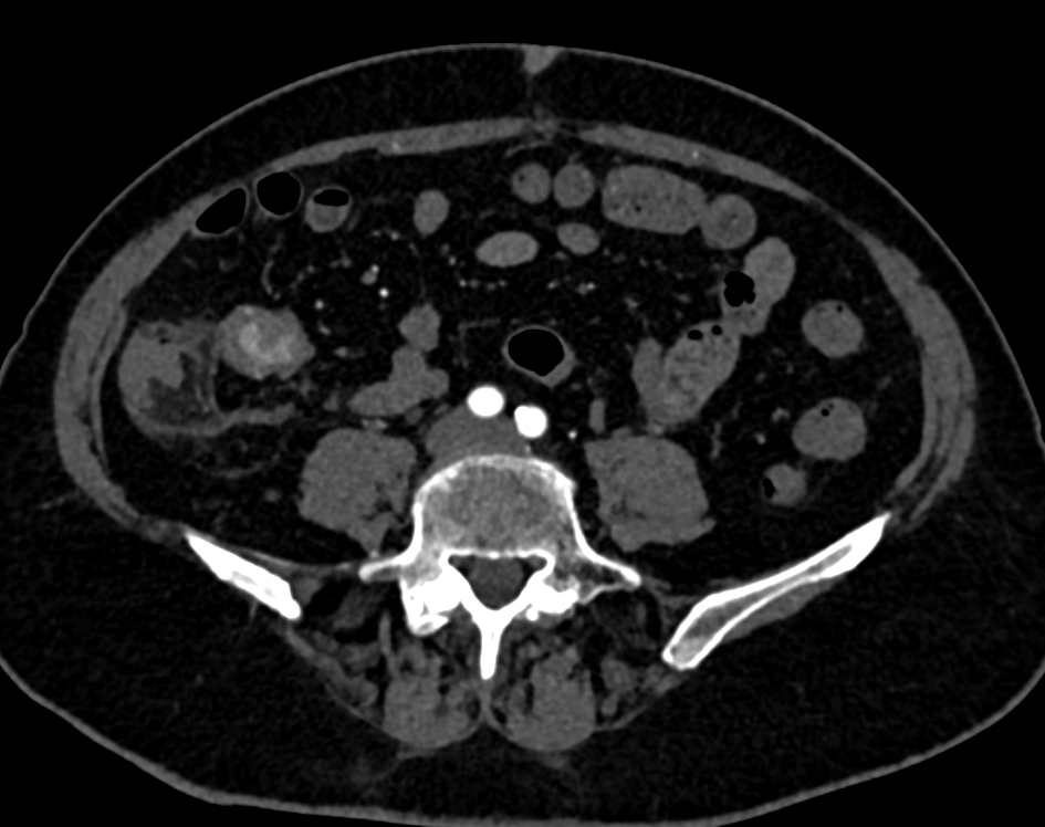 CTisus Quiz