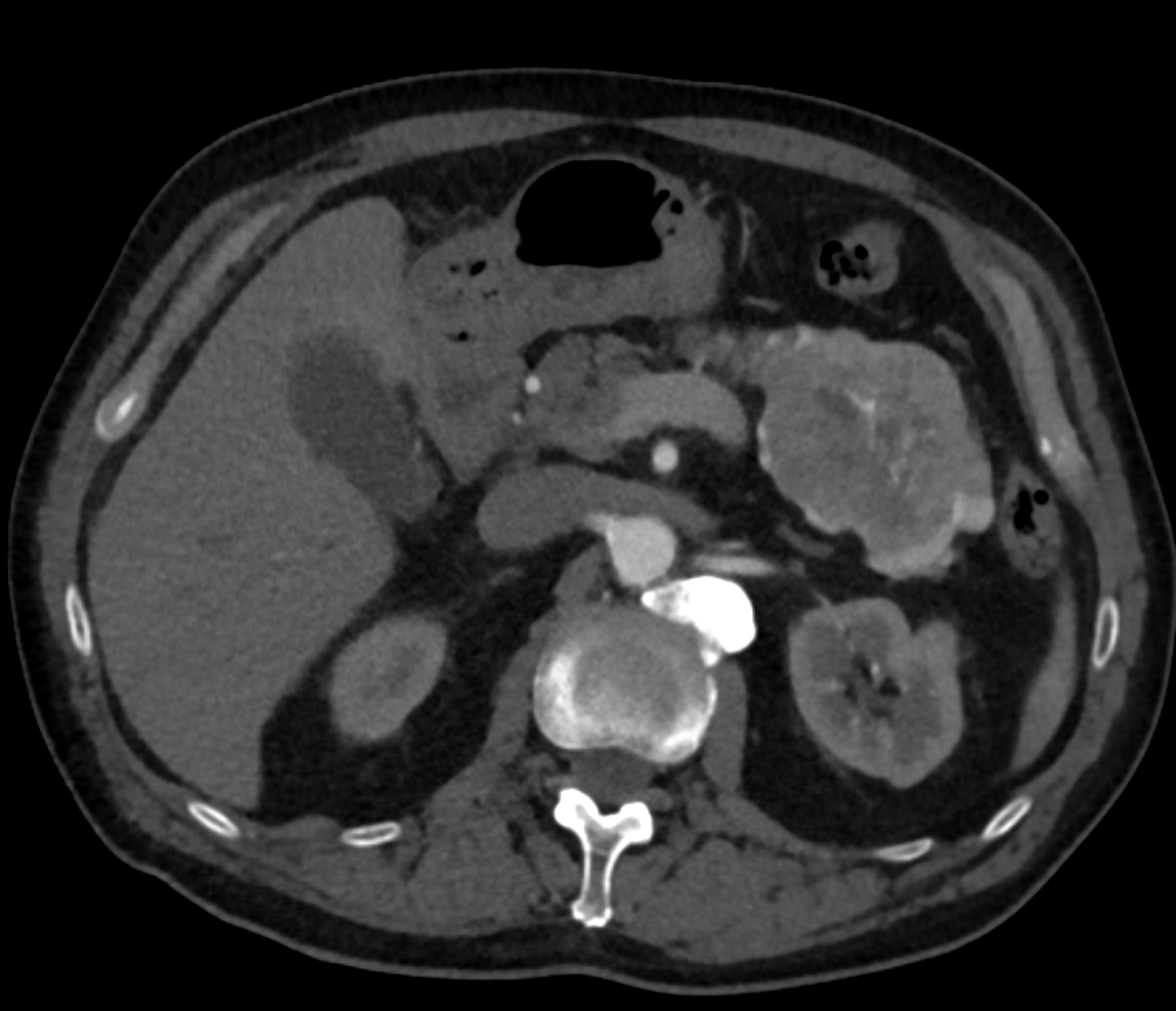 CTisus Quiz