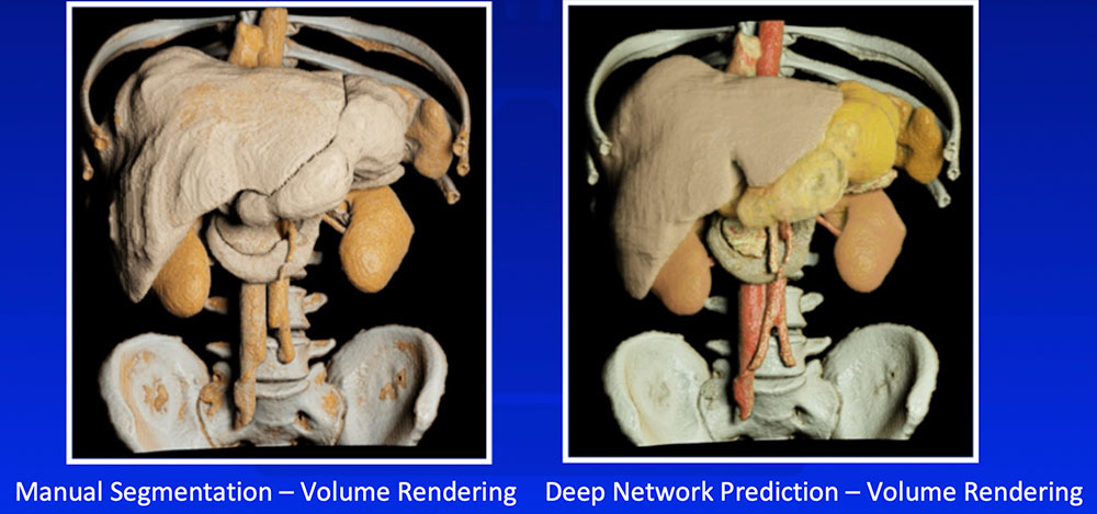 Multi-Organ Segmentation