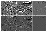 Radiomics