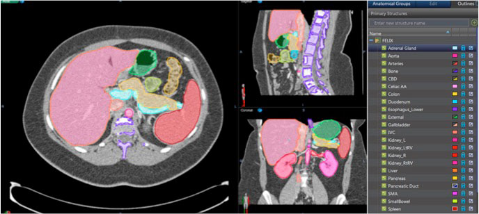 Deep network prediction of normal pancreas