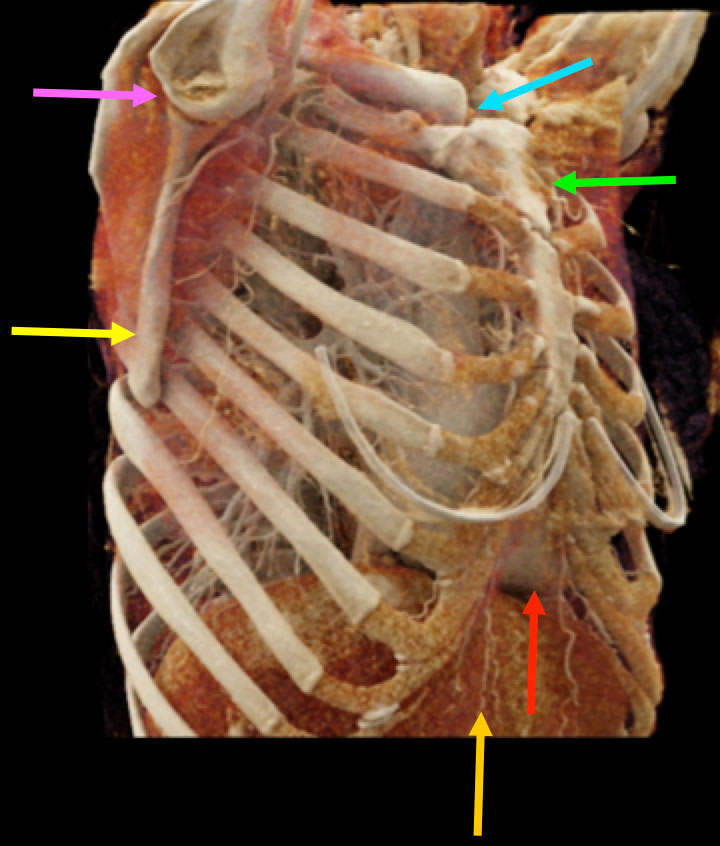 Bones