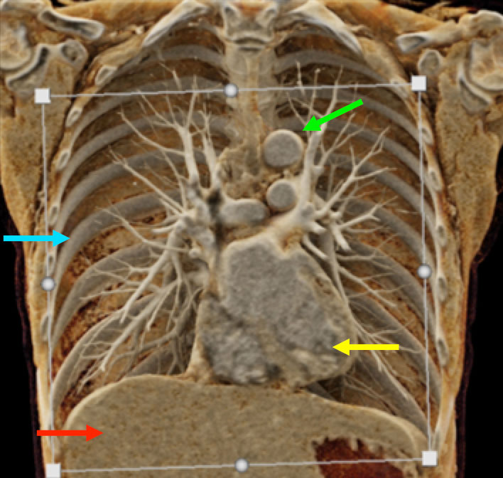 Cardiac