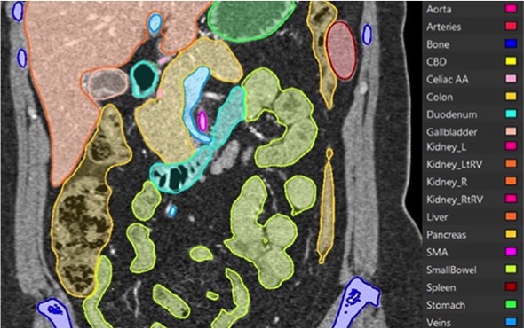 Image Segmentation (Normal CT)