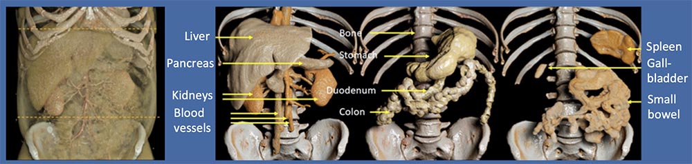2D vs. 3D Image Segmentation