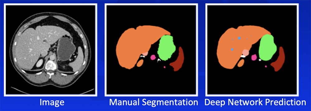 Deep Learning - Our Experience