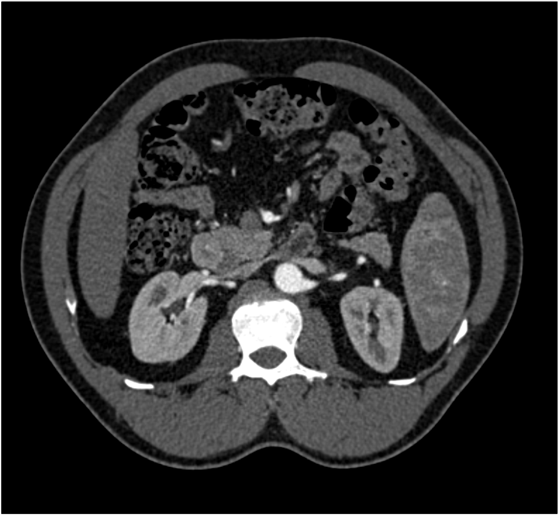 CTisus Quiz