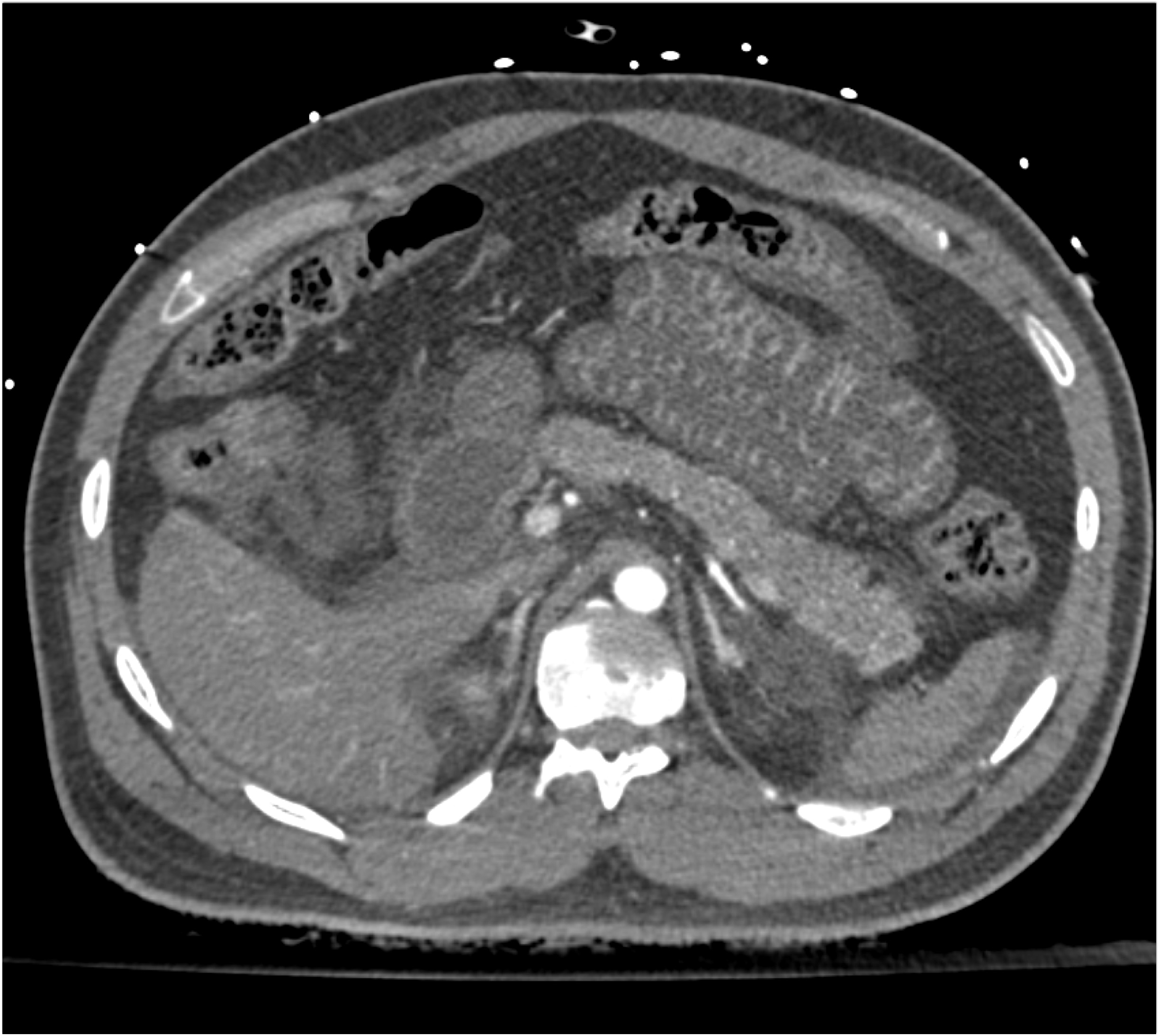 CTisus Quiz