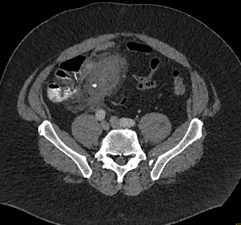 CTisus Quiz
