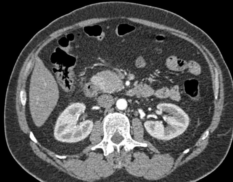 CTisus Case Studies