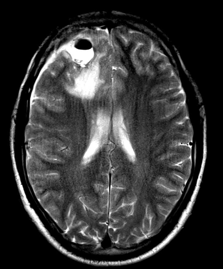 CTisus Case Studies