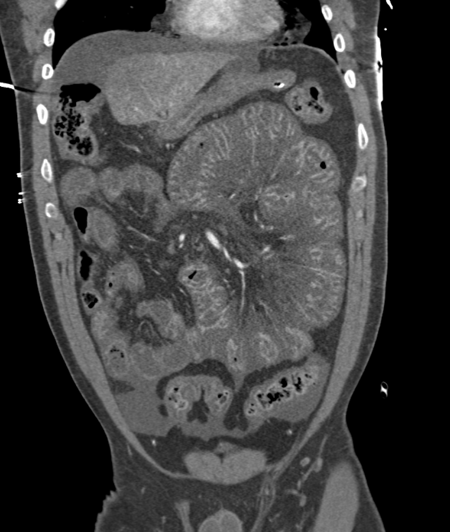 CTisus Quiz