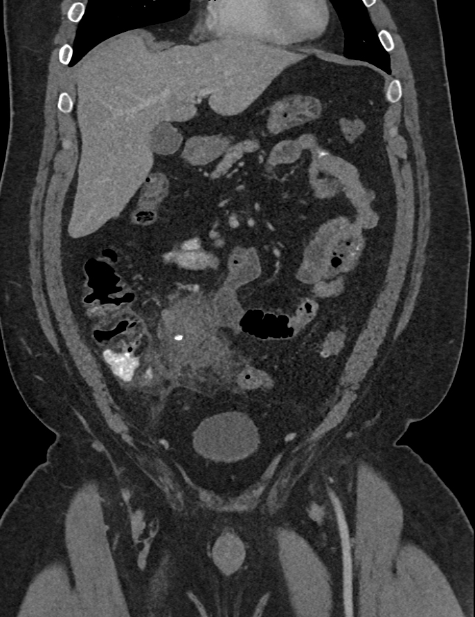 CTisus Quiz