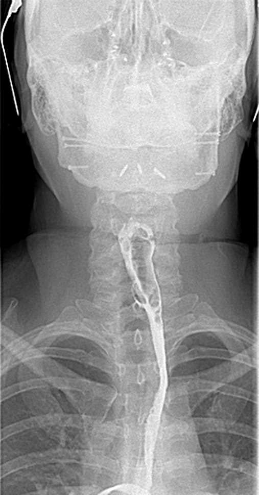 CTisus Case Studies