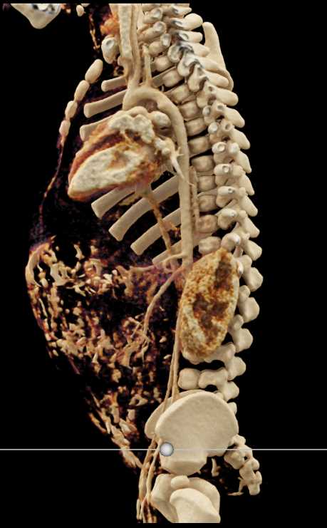 CTisus Case Studies