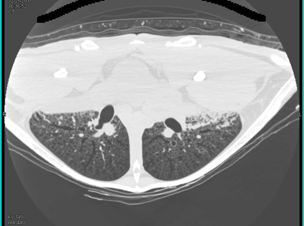 CTisus Case Studies