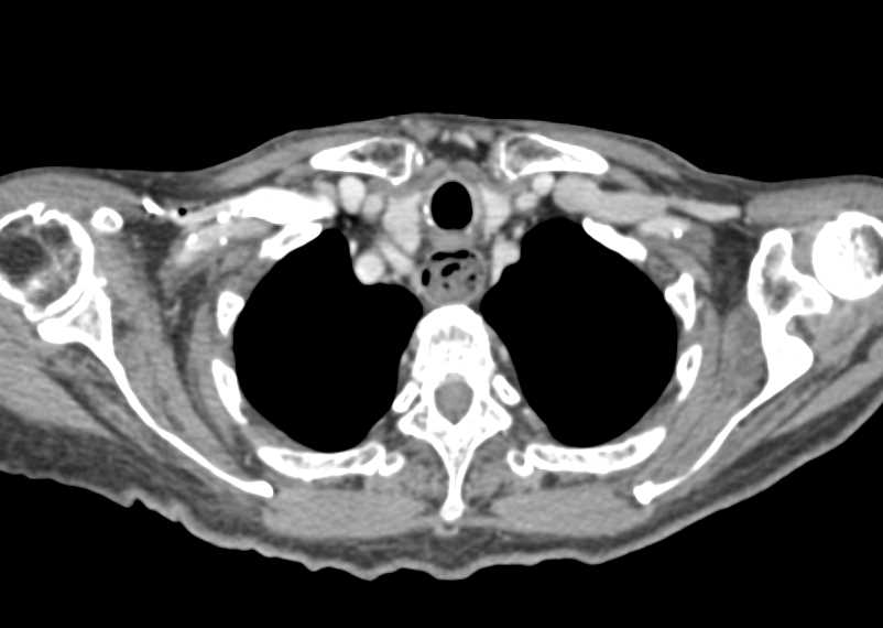 CTisus Case Studies