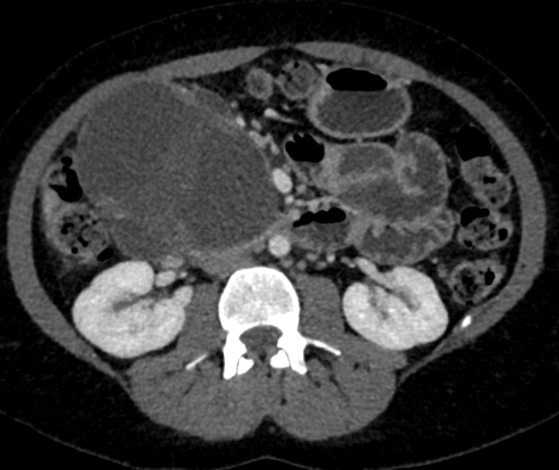 CTisus Quiz