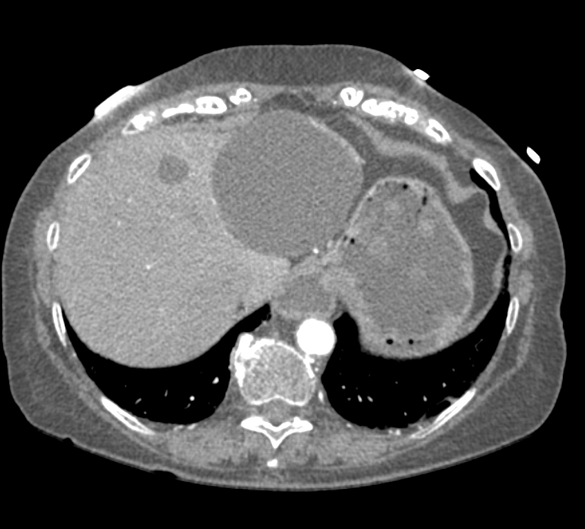 CTisus Quiz