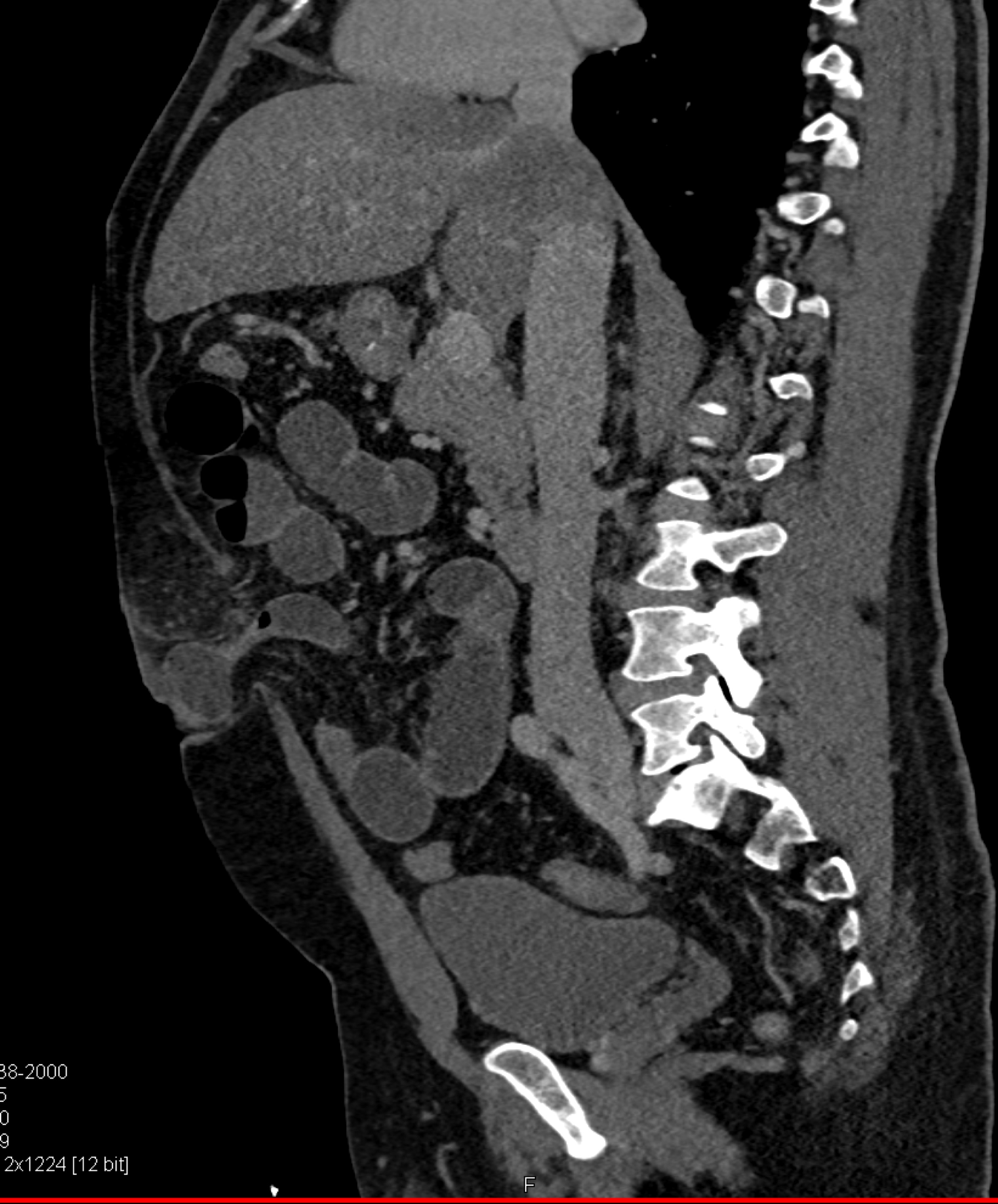 CTisus Quiz