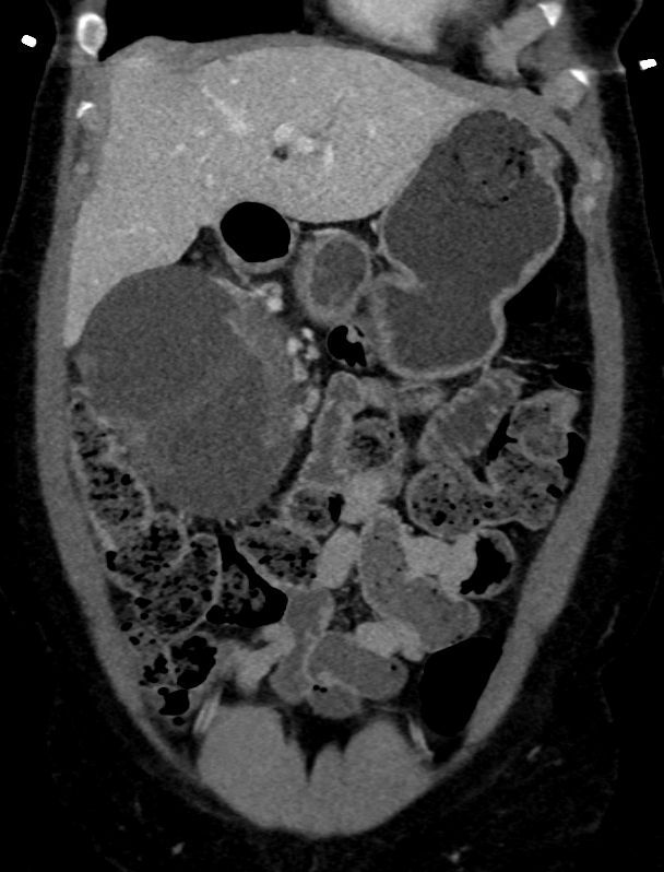 CTisus Quiz