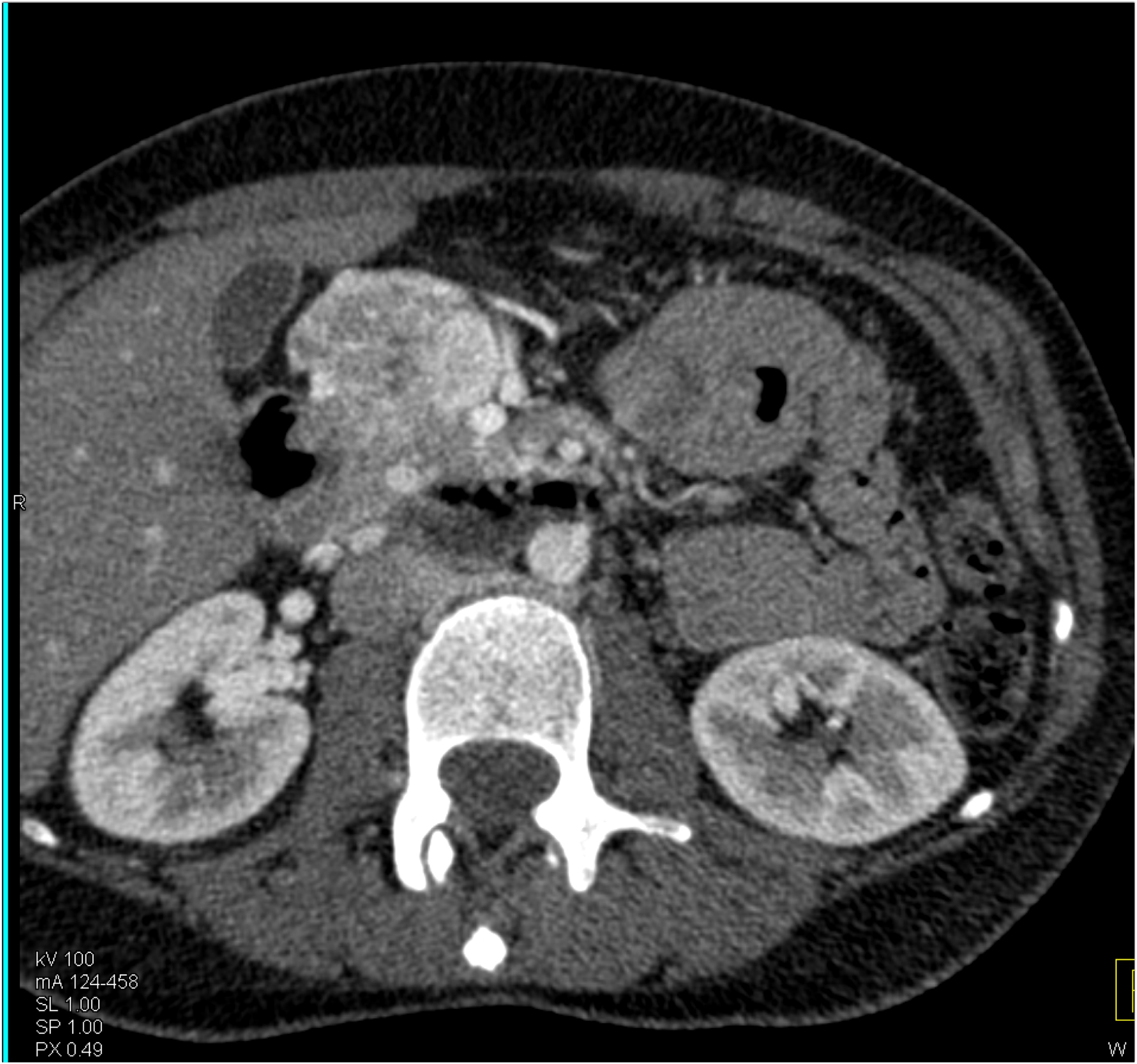 CTisus Quiz