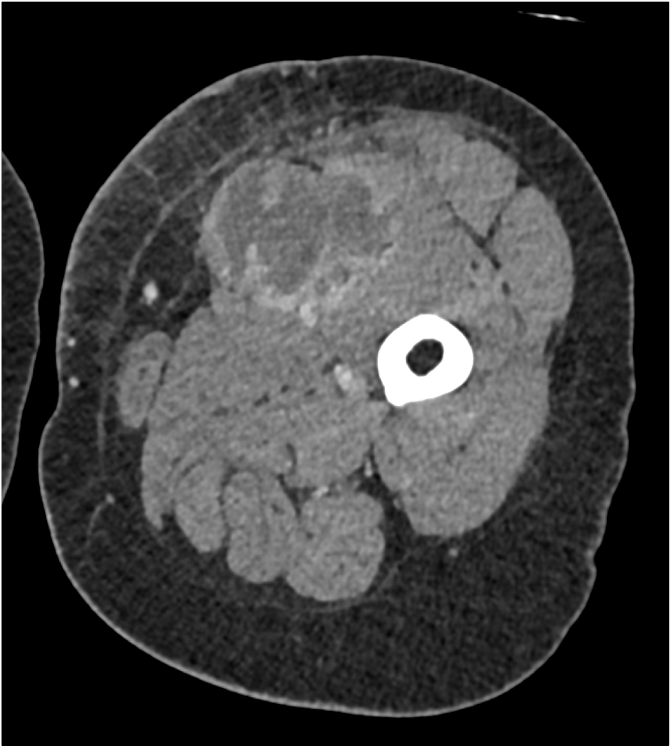 CTisus Quiz