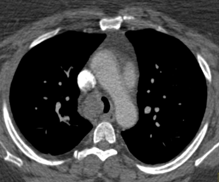 CTisus Quiz