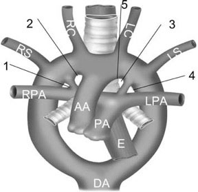 Simplified Late Stage Aortic Arch Development
