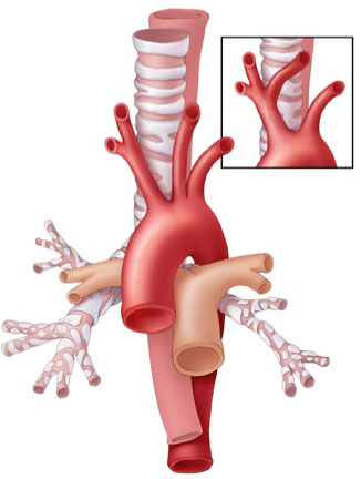 Normal Anatomy