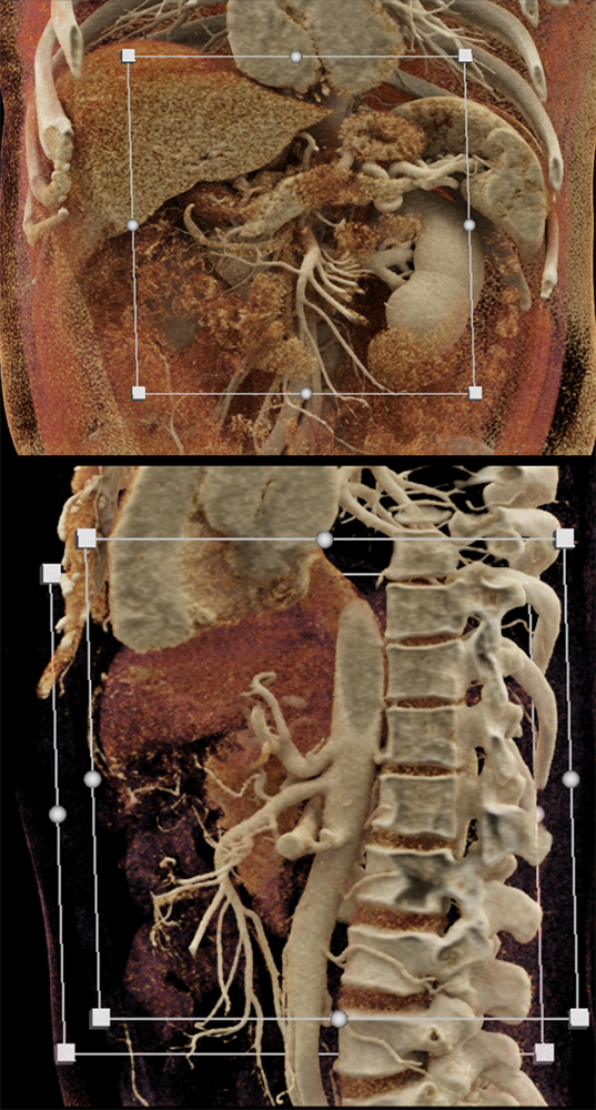 AI in Radiology: Current Status