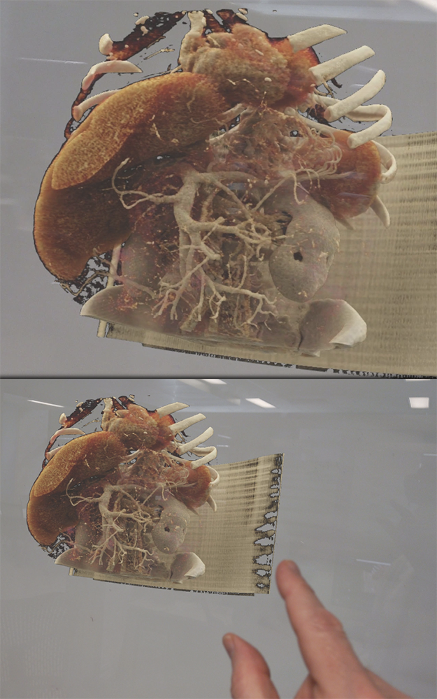 AI in Radiology: Current Status