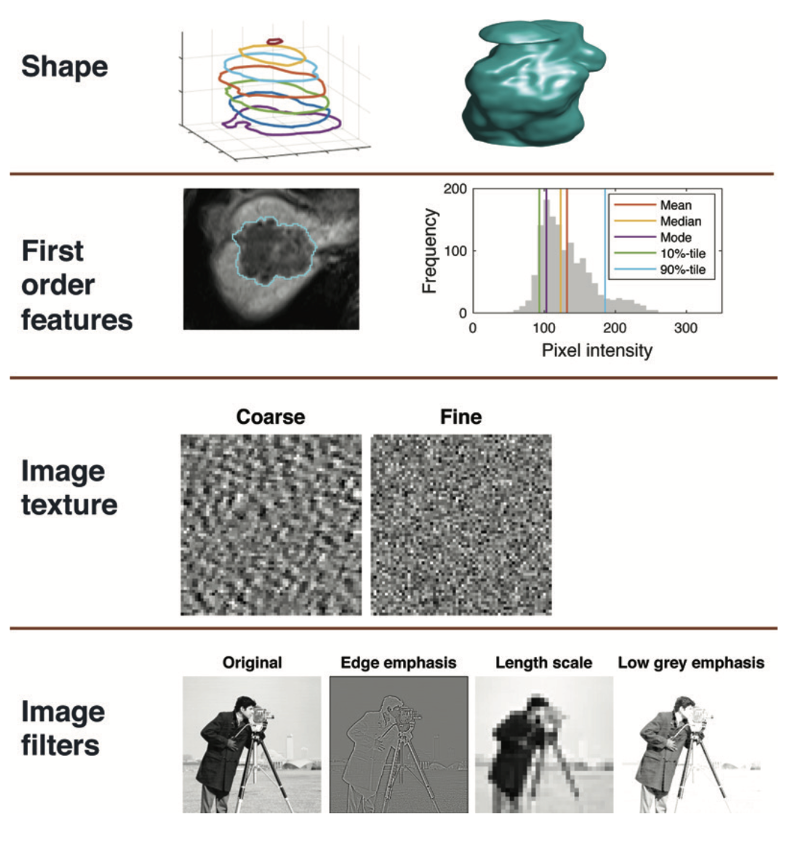 AI in Radiology: Current Status