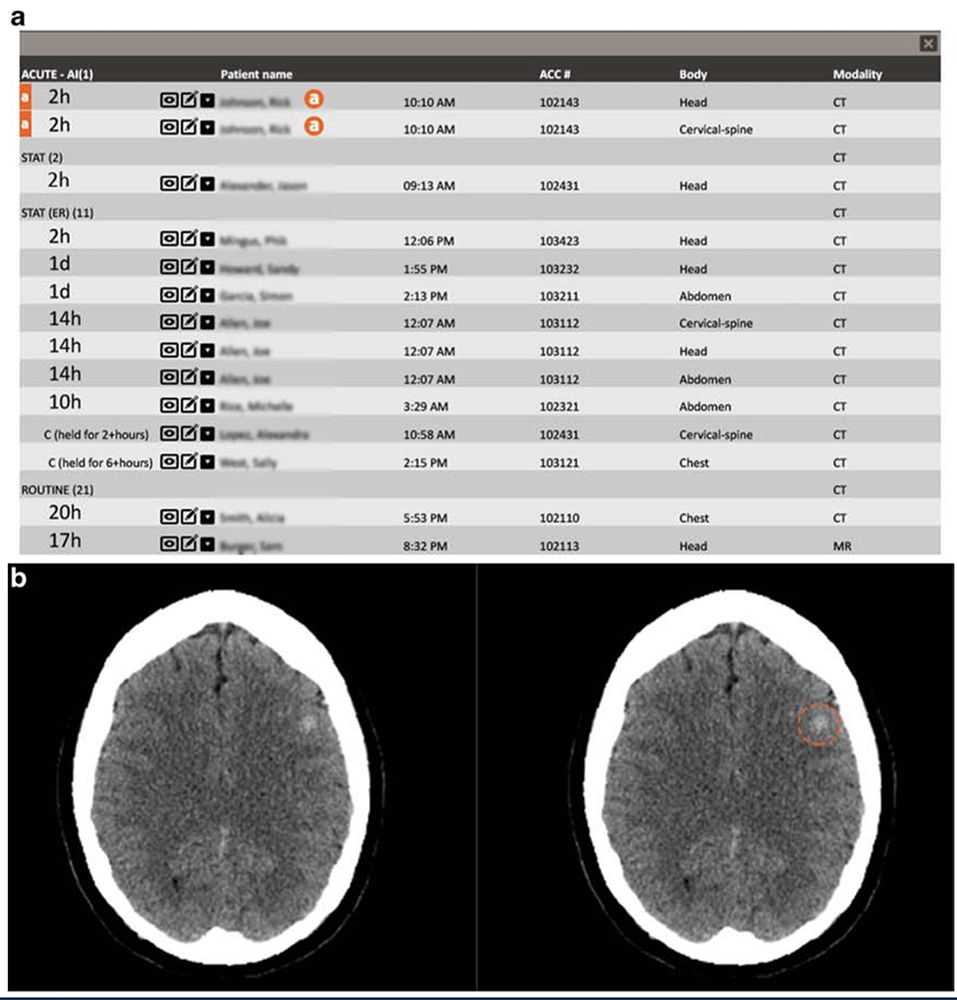 AI in the Emergency Room