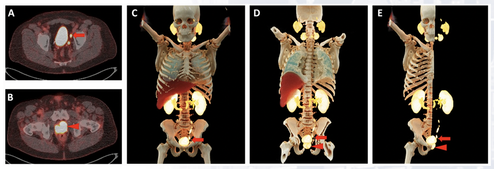 Cinematic Rendering of Mediastinal Pathology