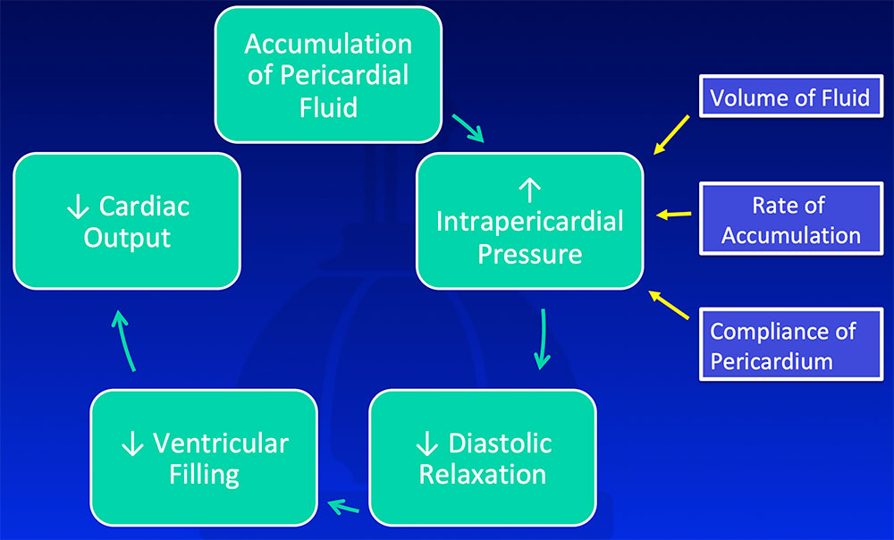 Cardiac Tamponade - Pathophysiology
