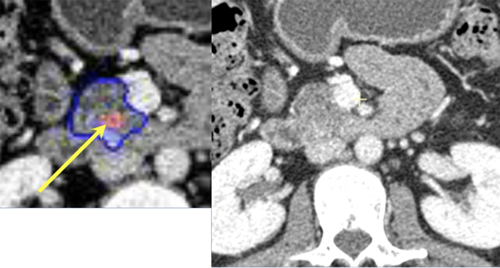 Example of False Positive Case of Deep Network Prediction